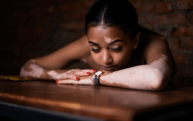 alcohol addiction treatment in Bend Oregon